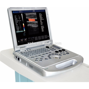 Nuevo escáner de ultrasonido de diagnóstico doppler color portátil con software 3d 4d